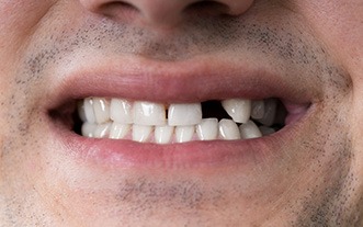 Male denture candidate in Glastonbury smiling while in a chair