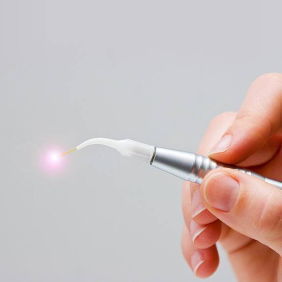 Hand holding a laser dentistry tool