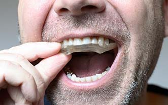 Man protecting his dental implants in Glastonbury with mouthguard