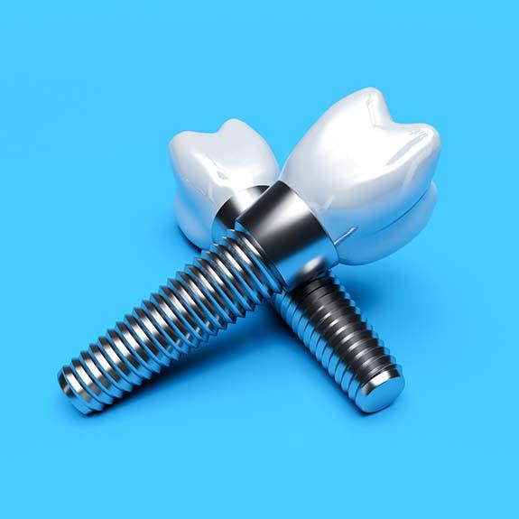 Closeup of dental implants in Glastonbury on blue background